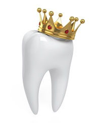 Dental-Crowns