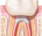 root-canals