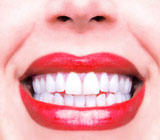 teeth-whitening-questions